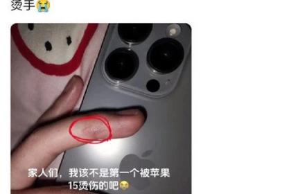 Pengguna iPhone 15 Pro terkena luka bakar karena overheat