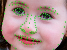 Face Recognition dapat deteksi kelainan genetik