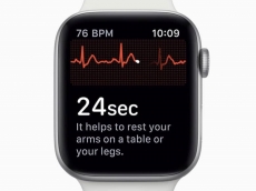 Apple Watch bakal bisa mendeteksi stroke lebih awal