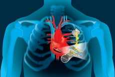 Ilmuwan kembangkan alat pacu jantung dengan baterai isi ulang
