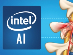 Intel kembangkan AI untuk mengobati syaraf tulang belakang yang terluka