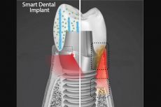 Ilmuwan ciptakan gigi yang dapat sembuhkan gusi dengan listrik