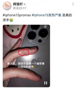 Pengguna iPhone 15 Pro terkena luka bakar karena overheat