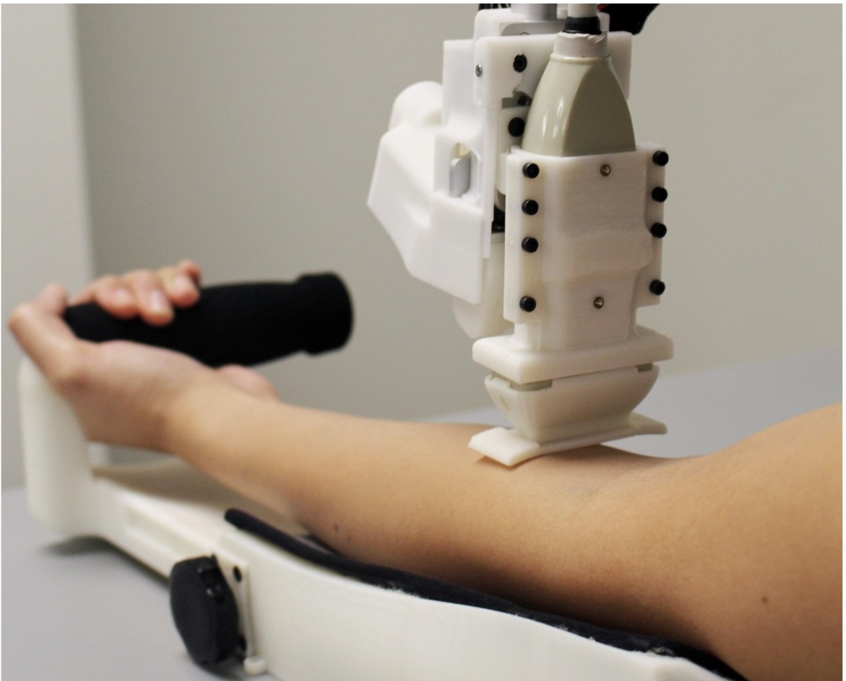 Robot berhasil ambil sampel darah dari lengan manusia