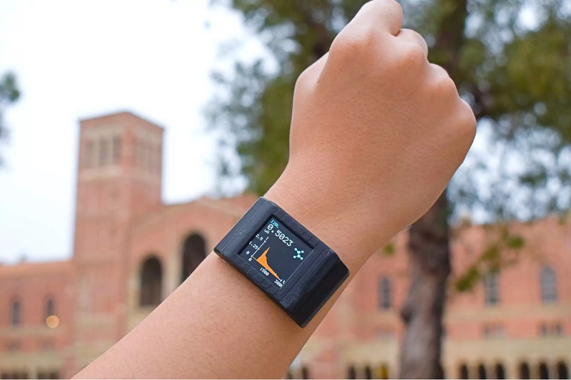 Andalkan sensor berukuran tipis, smartwatch dapat pantau kesehatan pengguna 