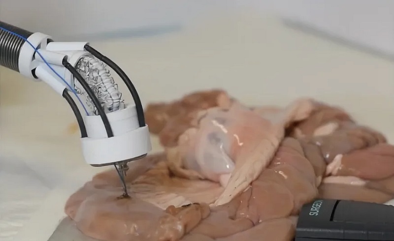 Ilmuwan Australia ciptakan bioprinter 3D untuk perbaiki jaringan organ